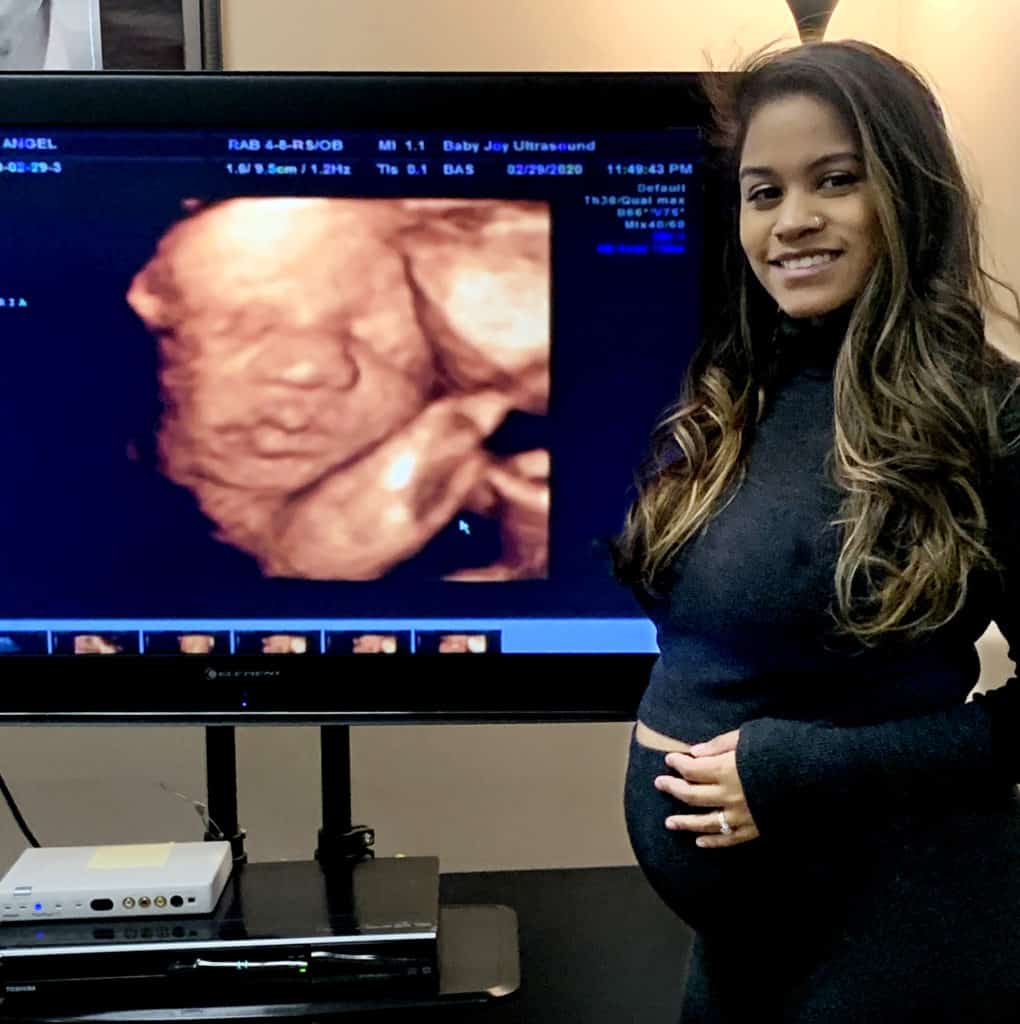 Baby Joy 3D/4D Ultrasound